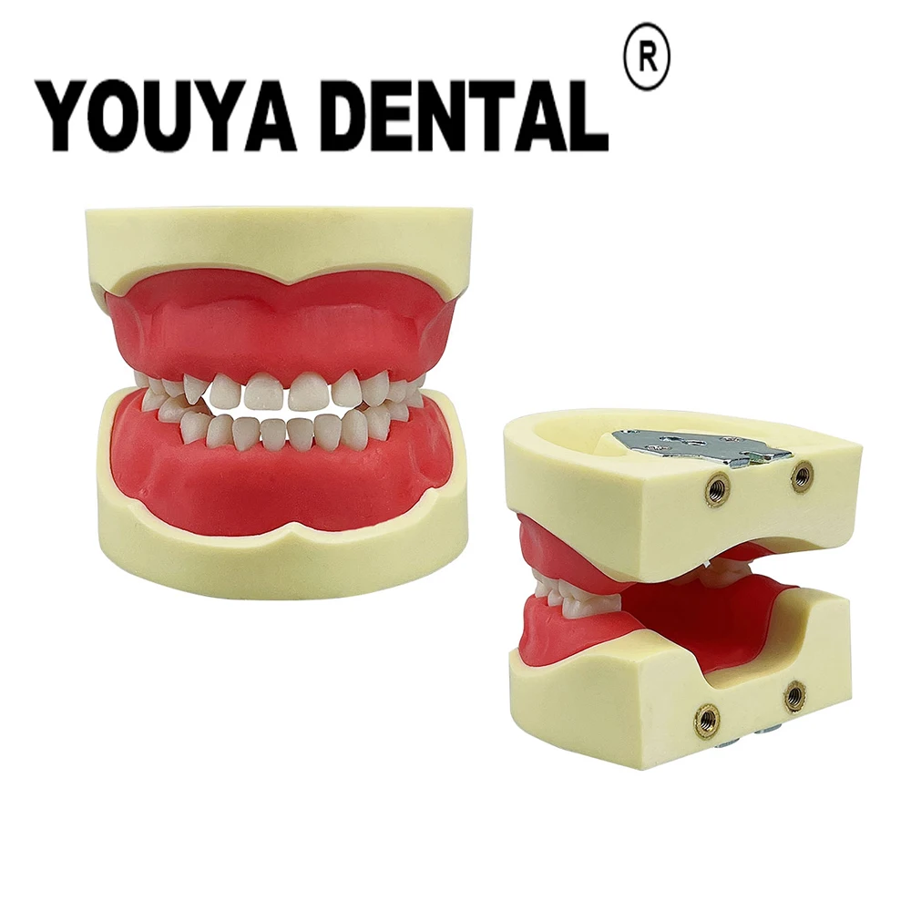 

Dental Child Teeth Teaching Model Typodont Gum Tooth Model For Dentist Technician Student Practice Studying Dentistry Equipment