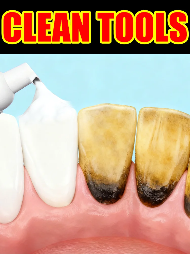 

New upgrade 3.0 Intraoral Mousse,Free shipping,unisex,Portable and lightweight