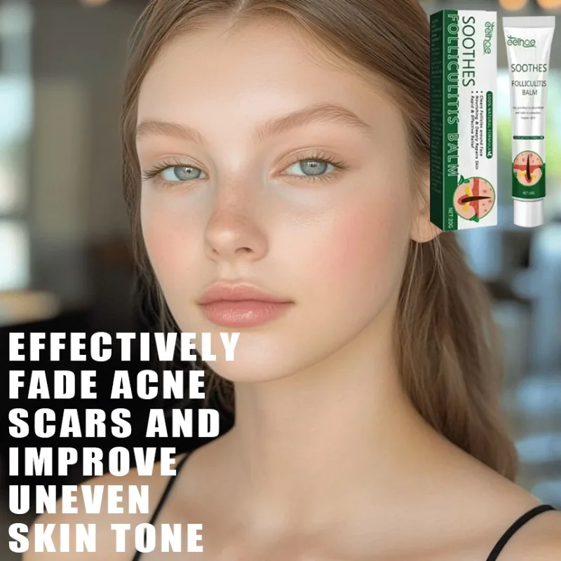 

Anti acne Cream Treatment of Acne Marked Skin Care Whitening&Acne Removing face cream Smooth&Whitening face cream