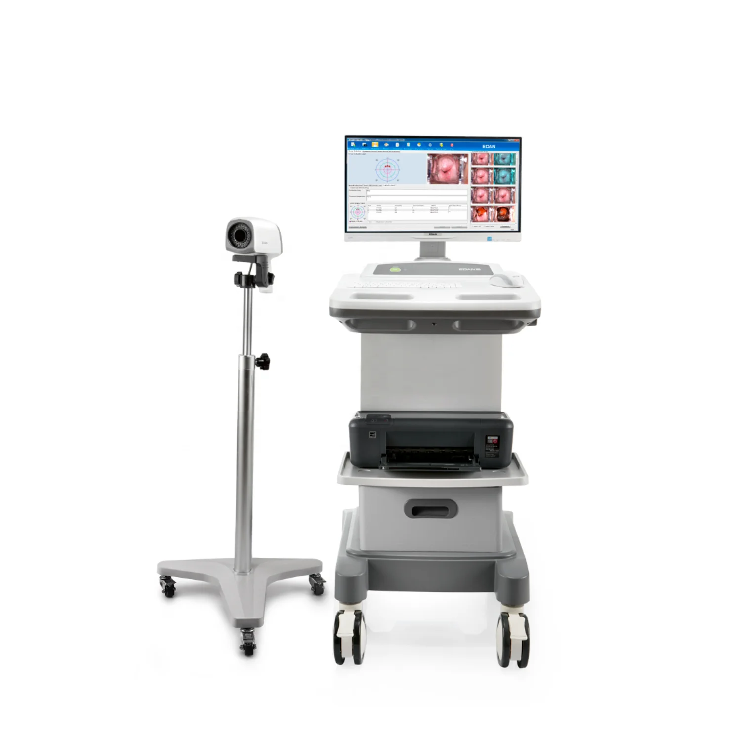 EDAN Video Digital Vaginal Imaging System Vaginal Examination Machine C3 with Rolling Stand