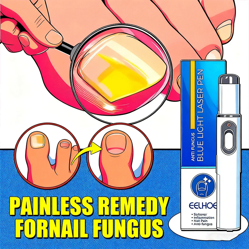 

Generation-2 Laser Says Goodbye To Nail fungus In 7 Days