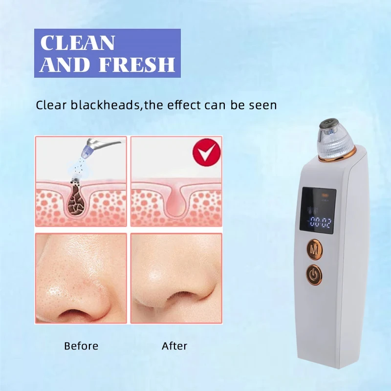 Electric Blackhead Remover Visual Vacuum Blackhead Acne Extractor Cleanser Face Nose Pore Deep Cleaning Skin Care Tools LESEN