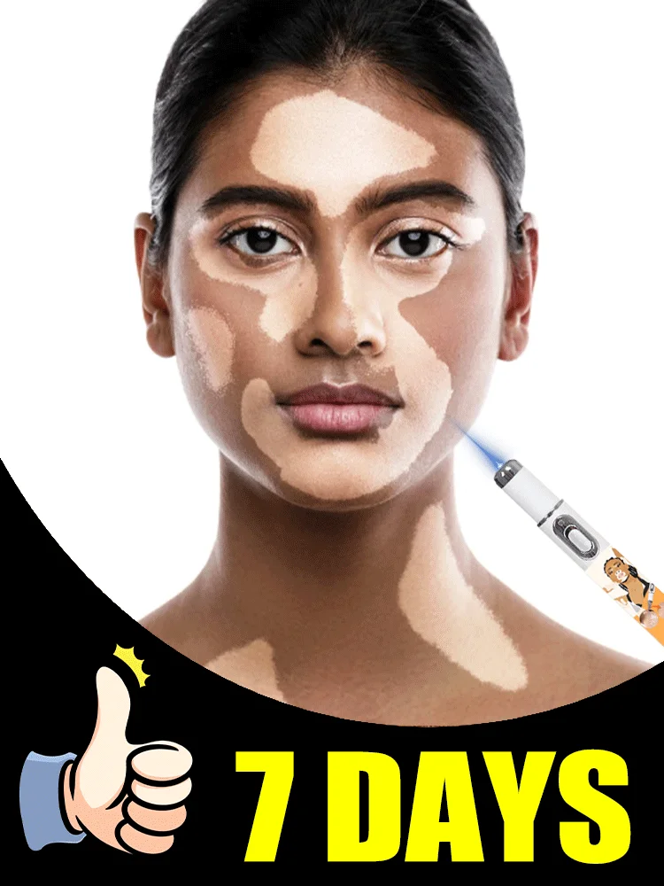 

2nd ᵍᵉⁿᵉʳᵃᵗⁱᵒⁿ ᵘᵖᵍʳᵃᵈᵉᵈ Vitiligo ⸴ ʳᵉpᵃⁱʳ Vitiligo ⸴ ᑫᵘⁱᶜᵏˡʸ