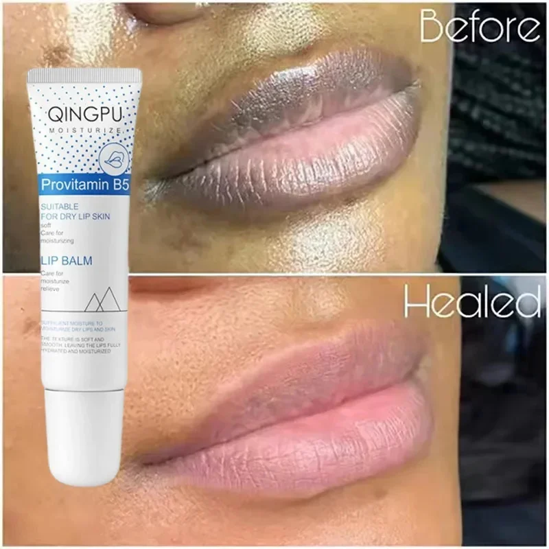 

Remove Dark Lip Balm Fast Lightening Pink Lip Exfoliating Fade Lip Line Dead Skin Moisturizer Korean Care Products Beauty Health