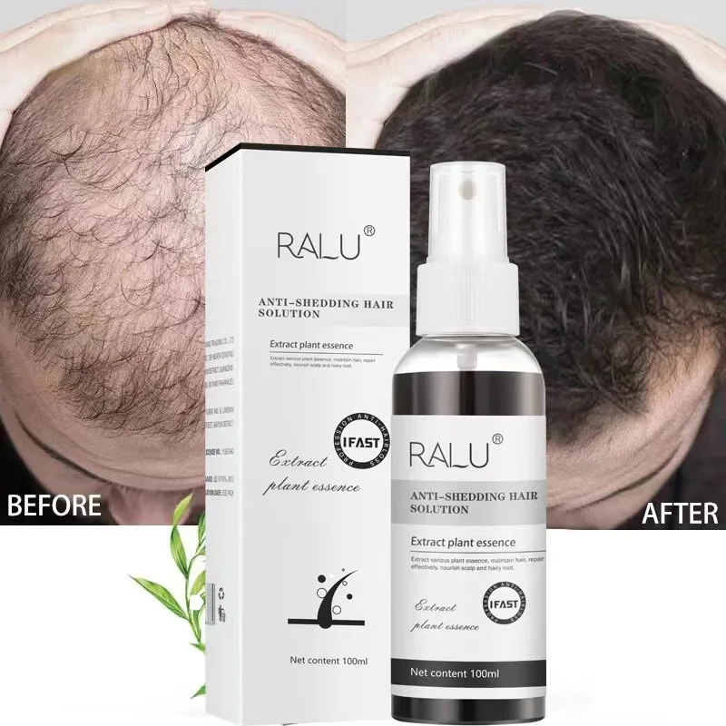 Scalp Revitalizing&Hair Nourishing essence Stabilizes Hair Root and Reduces Hair Loss