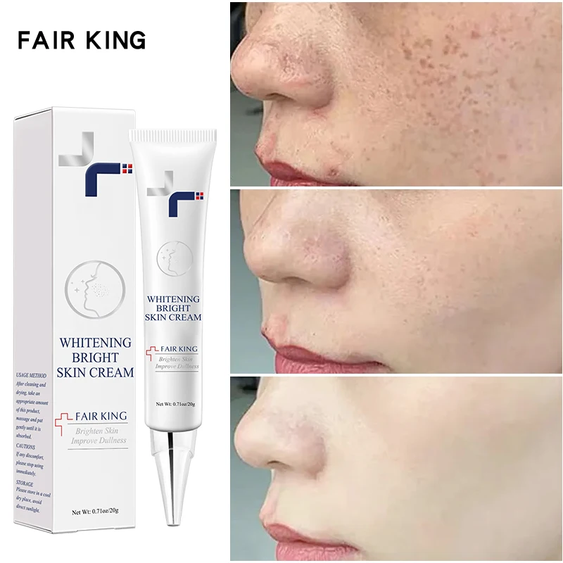 Dark Spot Corrector Skin Whitening Fade Cream Lightening Blemish Removal Serum Reduces Age Spots Freckles Face Cream 20g