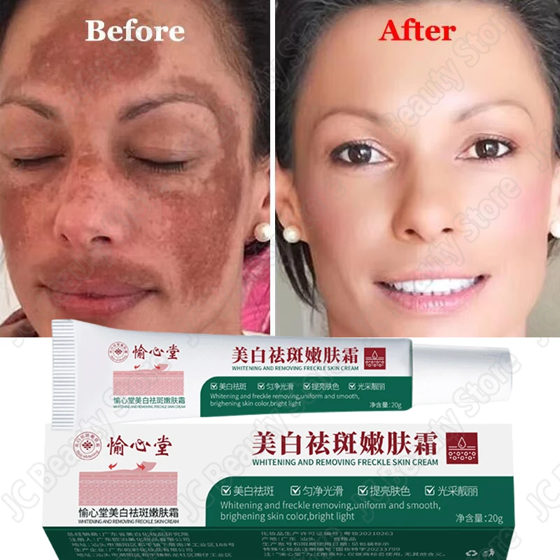 Güçlü nokta çıkarma beyazlatıcı krem cildi aydınlatmak hızlı Melanin pigmentasyon melazma koyu lekeler kore cilt bakımı ortadan kaldırır