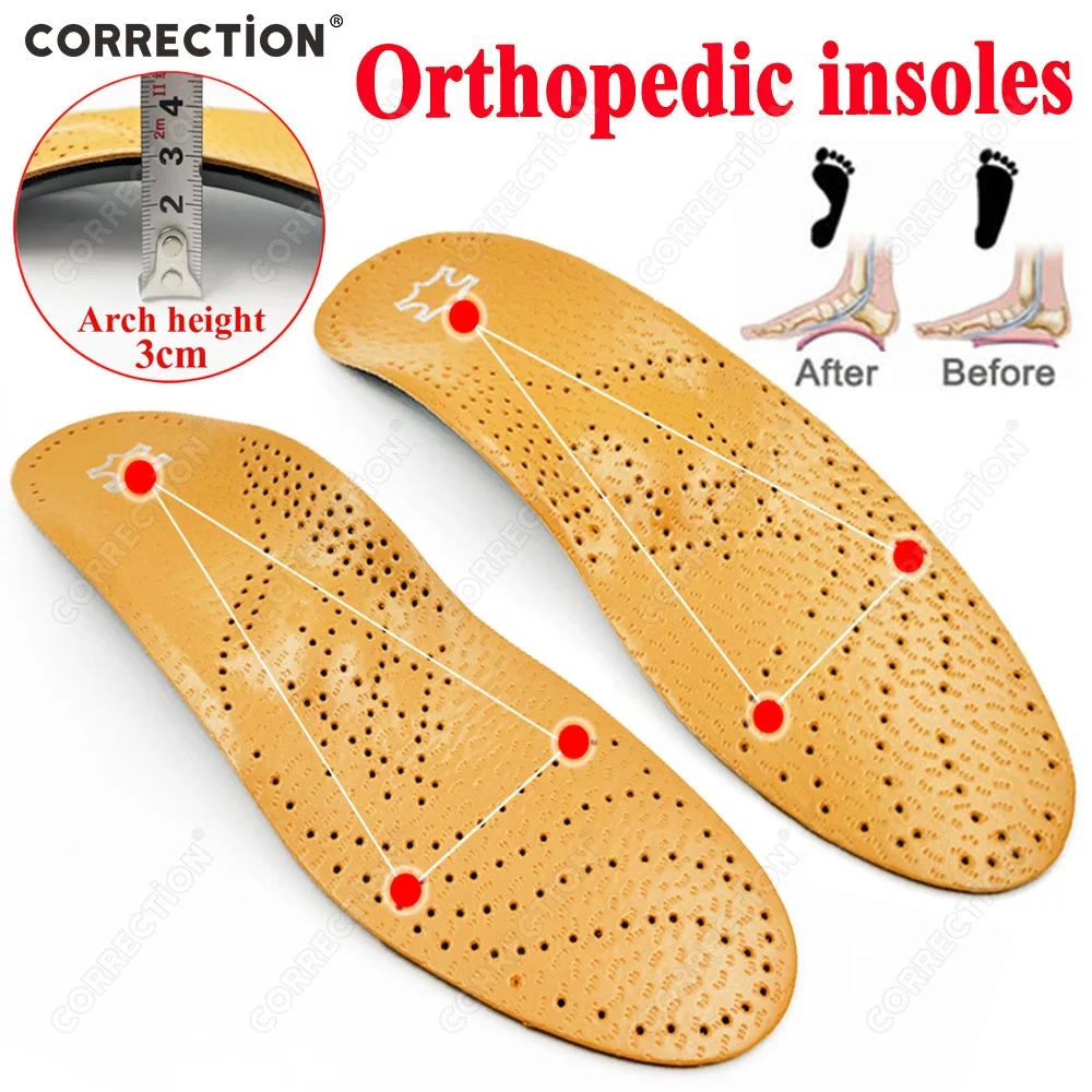 

CORRECTION Leather Orthotic Shoe Sole Insoles For Feet Gel Pad Arch Support Flat Feet For Women Men orthopedic Foot pain Inserts