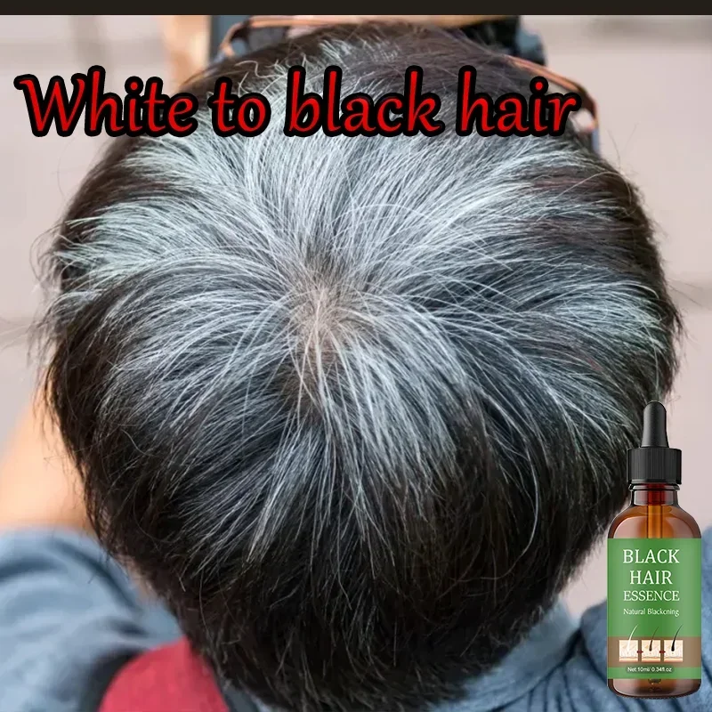 Suero de esencia para el cuidado del cabello blanco, tratamiento para el cabello blanco, convierte rápidamente el aire blanco en negro, reparaciones naturales