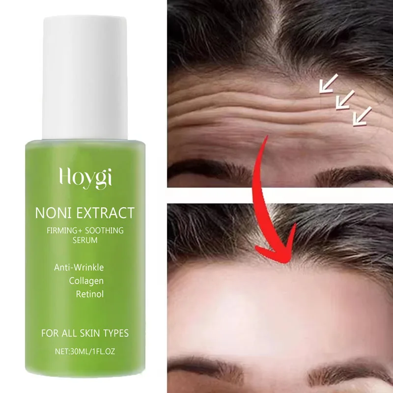 

Instant Wrinkle Remover Serum Anti-Aging Lifting Firming Fade Fine Lines Improves Skin Dullness Moisturize Face Korean Cosmetics