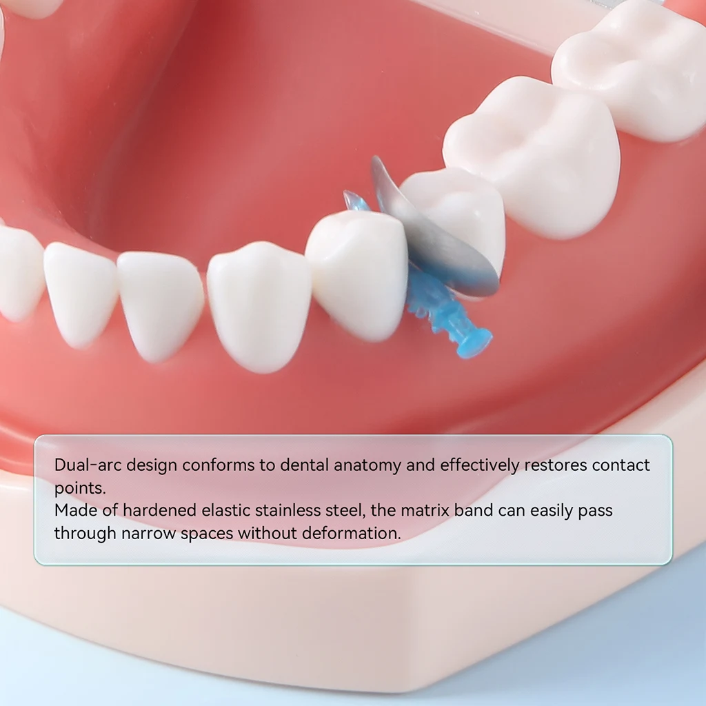 100 Stück/Packung AZDENT Dental Metallmatrizen, Sektionale Matrizenbänder, Konturiert M10, Harte Nachfüllformblätter, Sterilisierbar, für Zahnmedizin – Detail 5