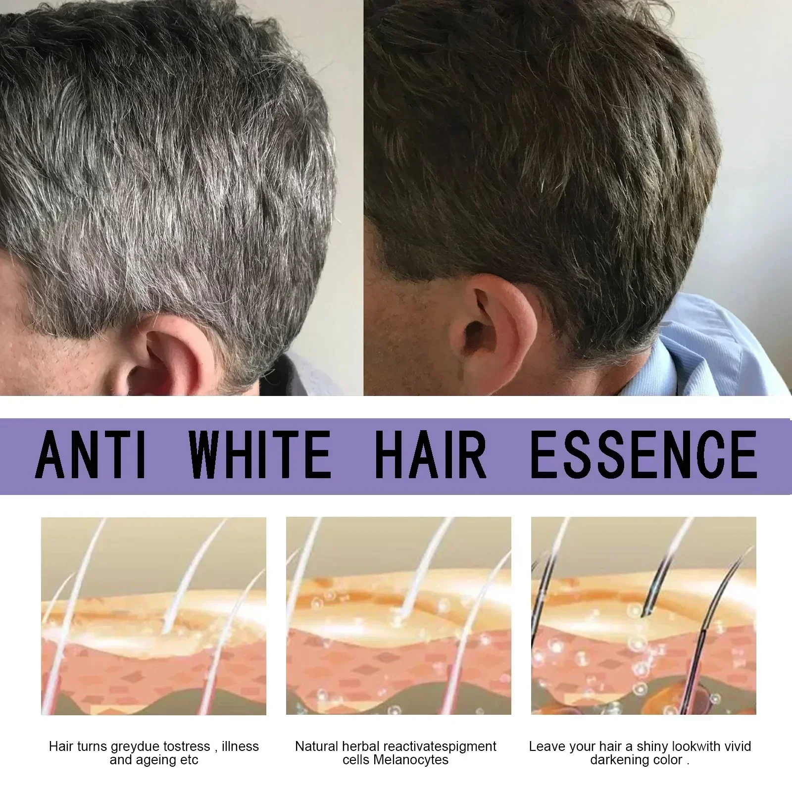 Anti cabelo cinzento soro tratamento remédio, branco escurecimento, reparação de cor natural, nutritivo cabelo cuidados produtos, branco para preto