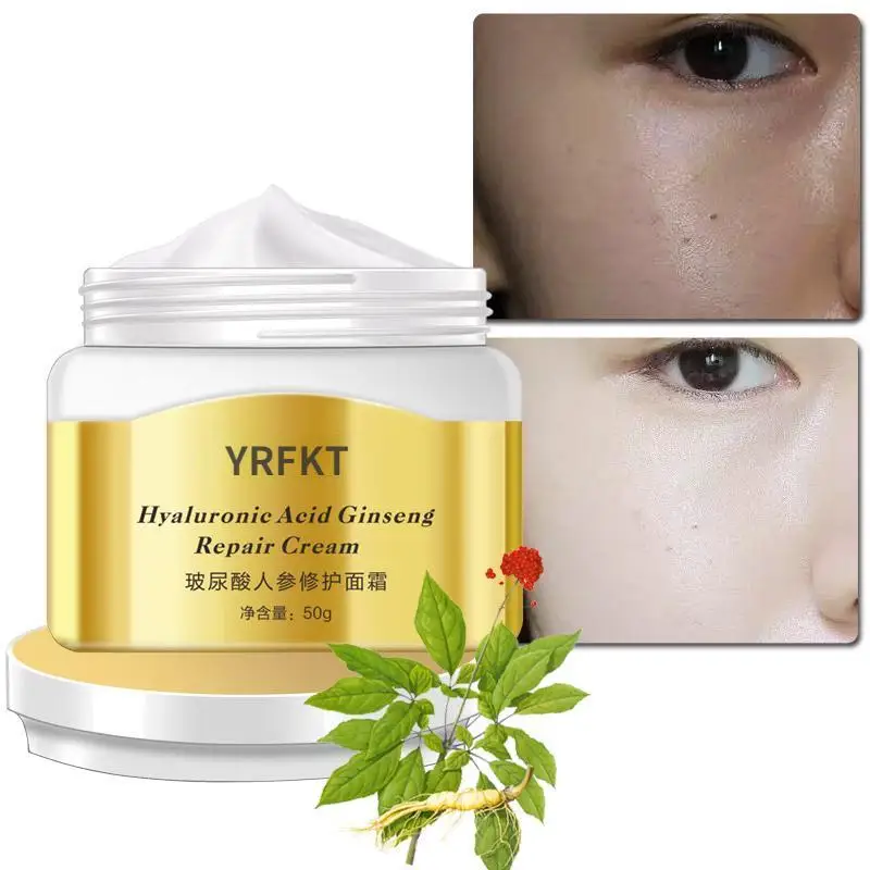 Hyaluronic acid ginseng acne removing cream acne removing printing face cream acne removing facial oil control skin care