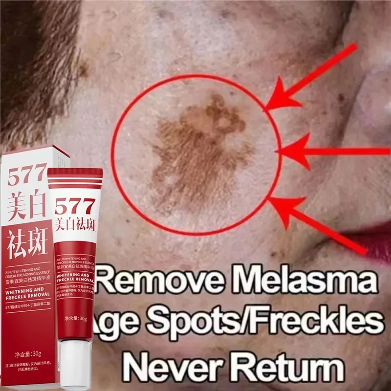 

577 Whitening Freckles Face Cream Remove Melasma Dark Spots Corrector Lighten Melanin Pigmentation Brightening Beauty Skin Care