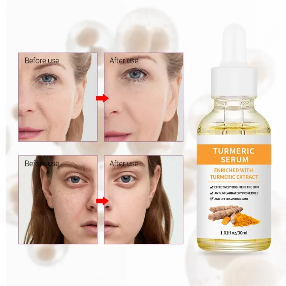 

Turmeric Serum Remove Dark Spot Anti-aging Bright Skin Face Serum Improve Dull Skin Reduce Fine Lines Whitening Facial Skin Care