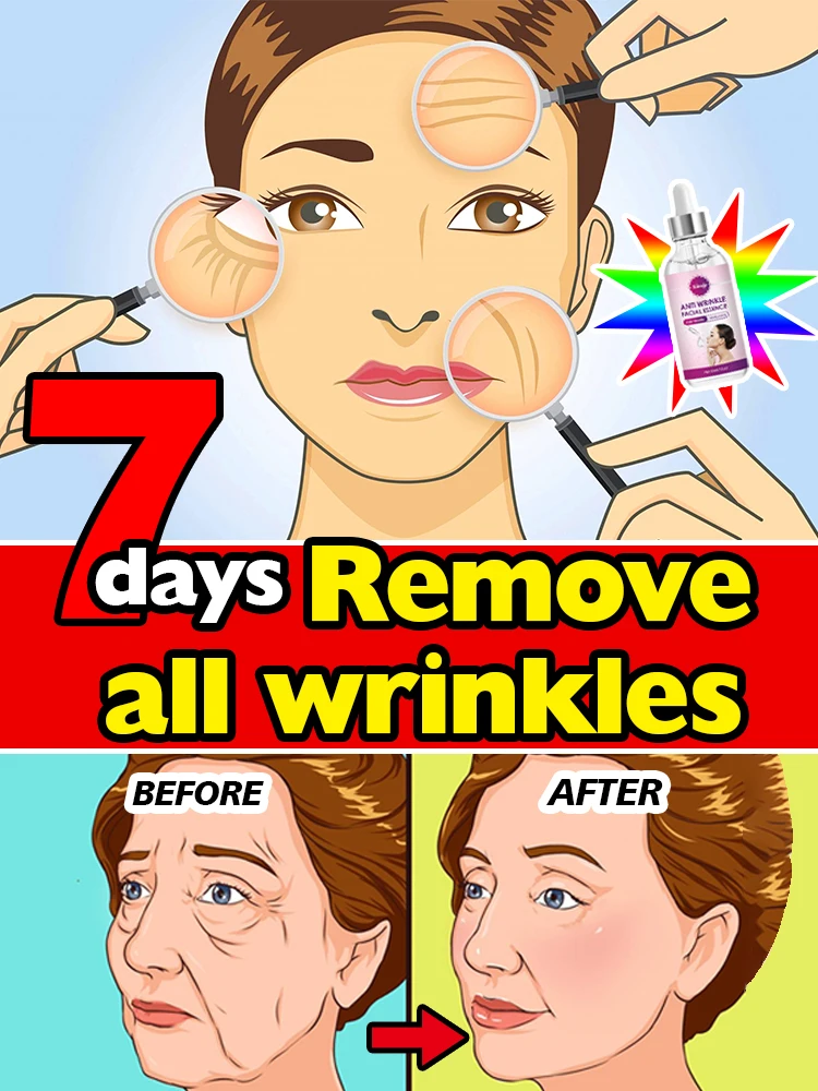 Solve all facial wrinkle problems