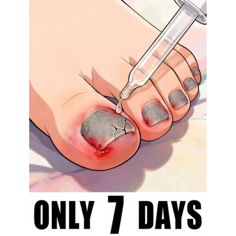 

Омоложение ht 2026 — технология предотвращения грибка — регулируемый контроль температуры и датчик безопасности