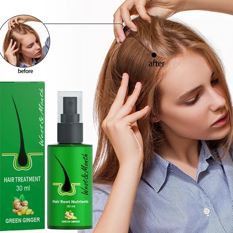 

Sdatter Herbal fast Hair Growth Products for Men women Anti-alopecia Spray Care Scalp Treatment Prevent Hair Loss Essential Oil