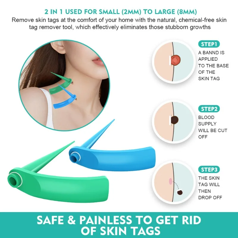 

Tagband Skin Tag Removal Tool Special Mole Marker To Remove Moles Without Leaving Scars or Marks