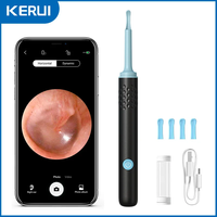 KERUI Ear Wax Removal Tool Spade Ear Cleaner 5MP Endoscope Camera Scope Remover WIFI APP Visual 6 LED Light iPhone Android