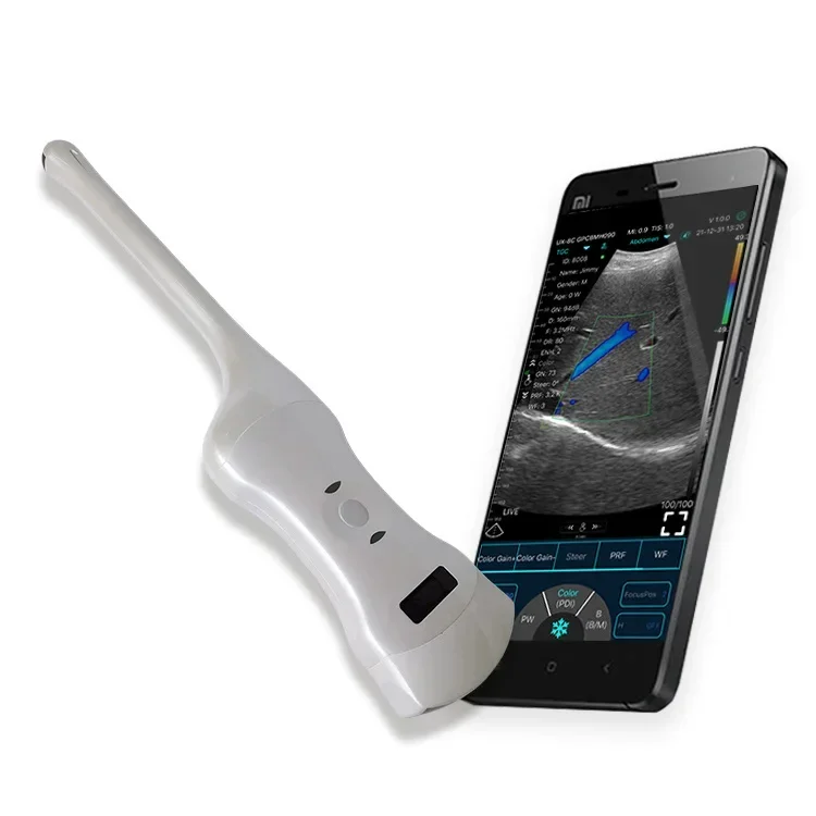 Professional Female Hand-Carried Portable Trans-vaginal Double Head 3 in 1 Color Doppler Wireless Ultrasound Probe