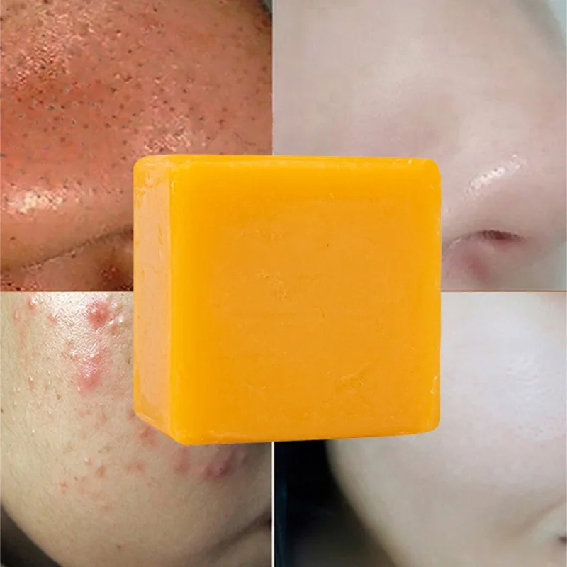 100G Kojic Acid Soap Kit Facial Cleaning Pores Dirt Acne Blackhead Anti-Acne Remove Deep Cleaning Oil Control Whitening Skin