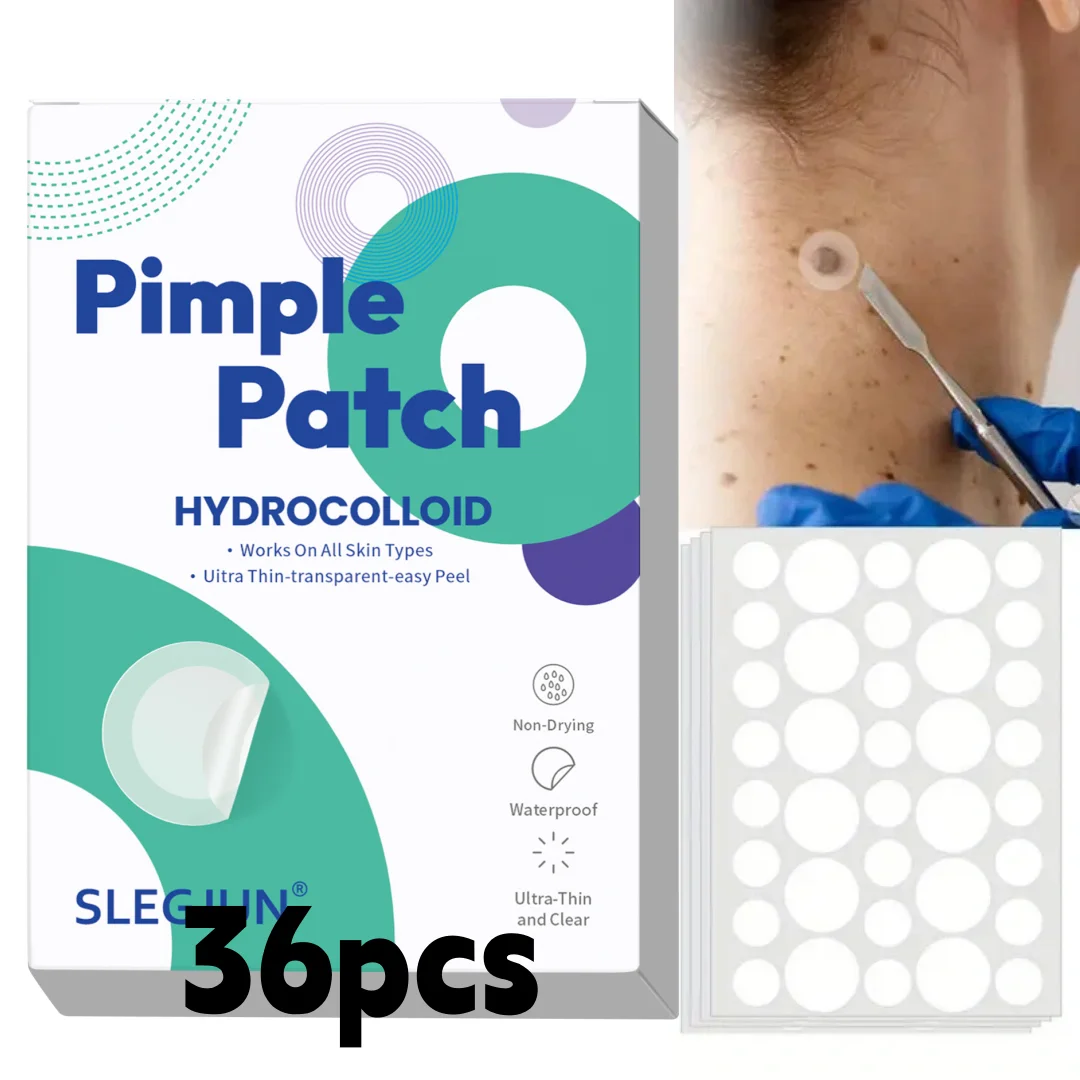 

20 шт., мультяшный пластырь от прыщей, милый кошачий консилер для лица, пластырь от прыщей, безопасный, нетоксичный.