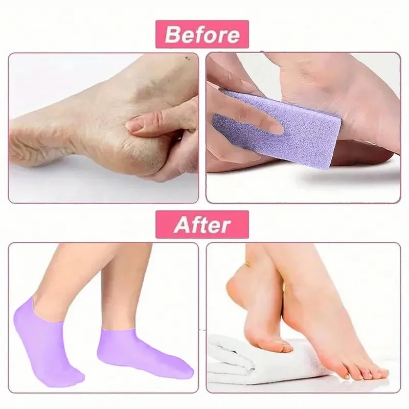 1 Paar geeignete Damen-Silikonsocken für trockene, rissige Füße, erhältlich in mehreren Farben für feuchtigkeitsspendende rissige Füße – Detail 3