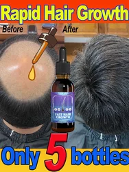 Essential oil promotes rapid hair growth and treats baldness and hair loss