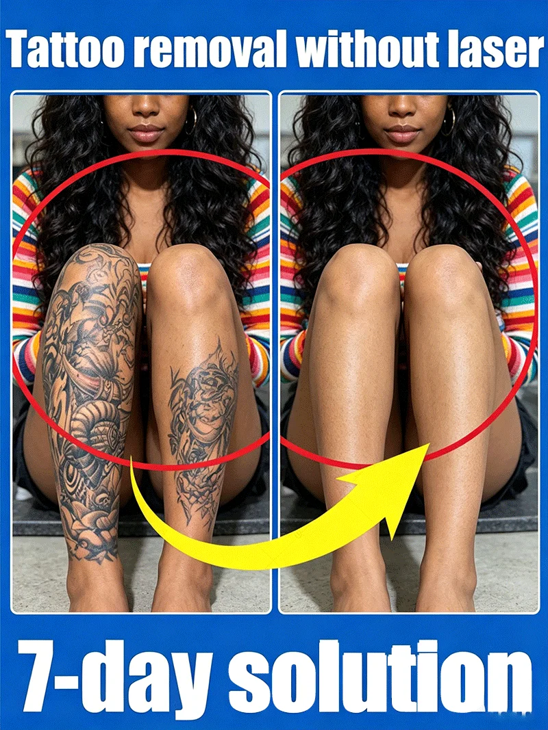 Pigmented permanent makeup tattoo removal Tattoo quick removal