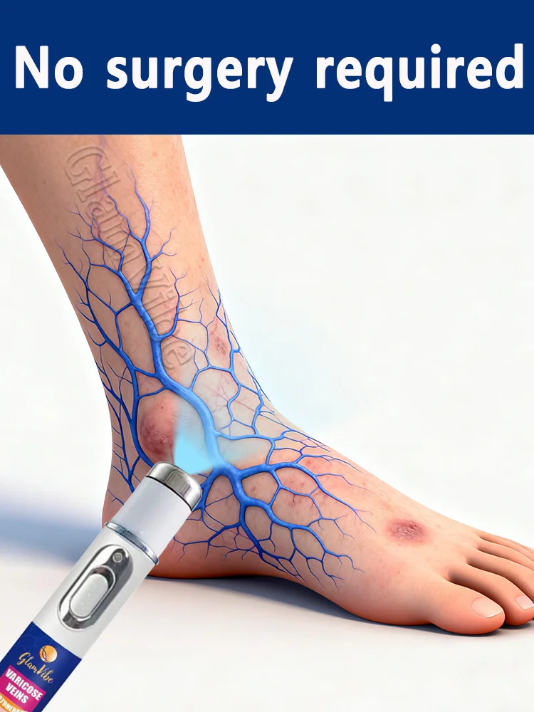 

People who sit for long periods, office workers, stay-at-home moms, and those who engage in high-intensity exercise