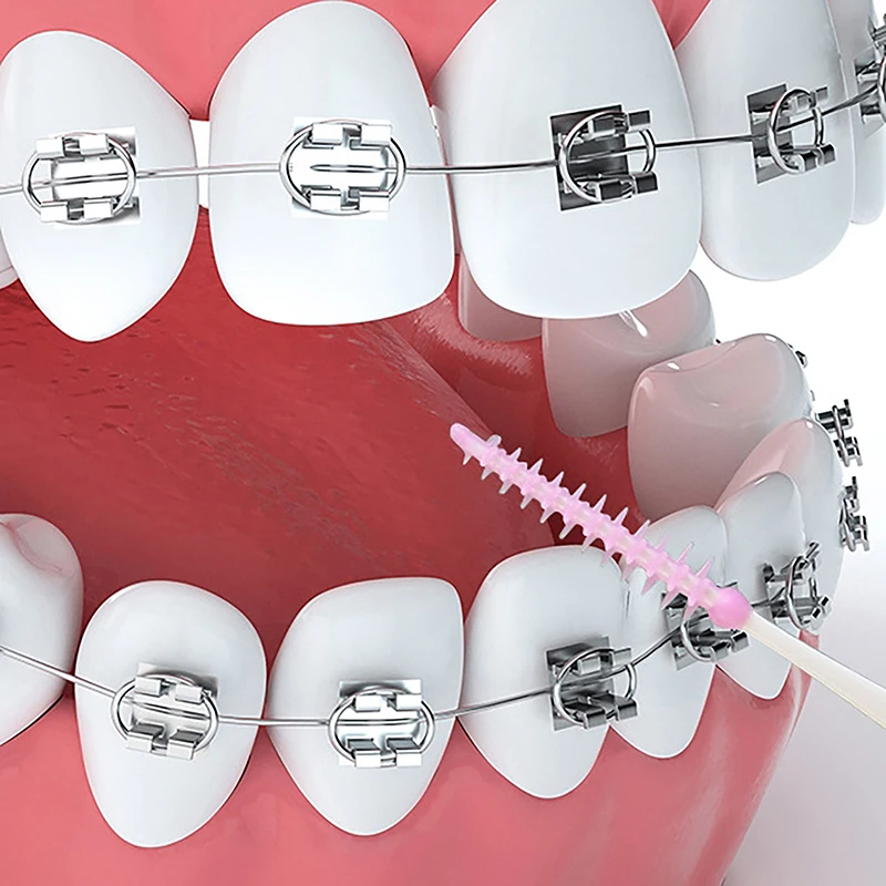 40 Stuks Interdentale Siliconen Borstels Dentale Tandenstokers Poetsen Tussen Tanden Siliconen Tandenstokers Met Draad Orale Reinigingsmiddelen