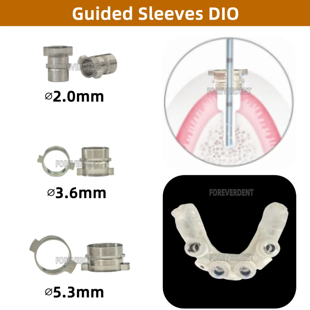 10 قطعة من الأكمام الموجهة الرقمية DIO للأسنان قالب تخطيط التصنيع الرقمي موضع الحفر 11 مقاسًا #2