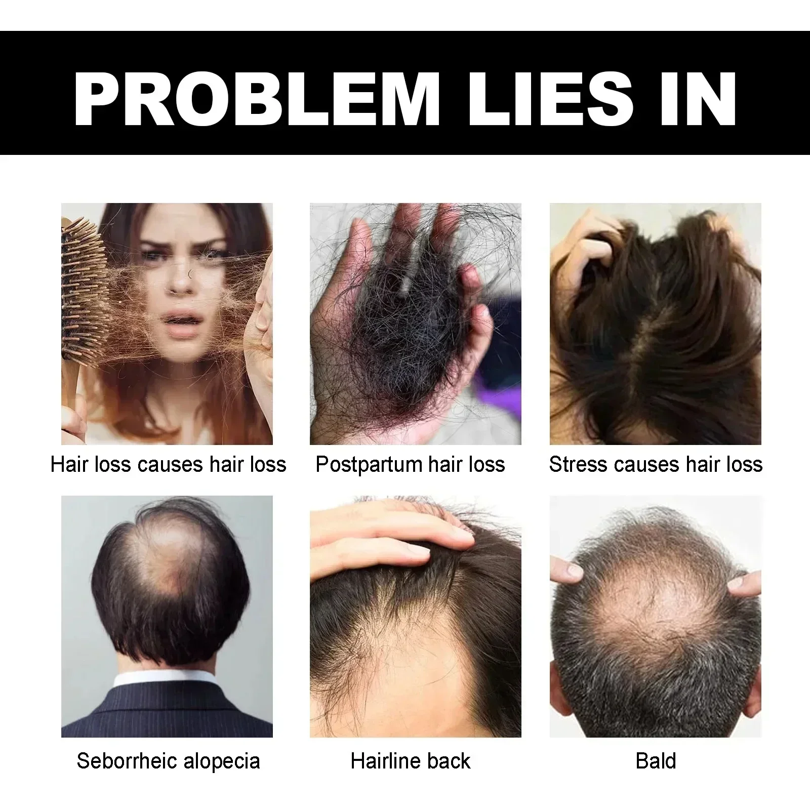 Prevent shedding, reduce hair loss, hair growth,