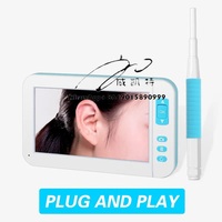 C01 4.3 Inch IPS Screen Endoscope Otoscope Visual Ear Cleaner Spoon Picker 1080p Camera Screen Visual Ear Wax Removal