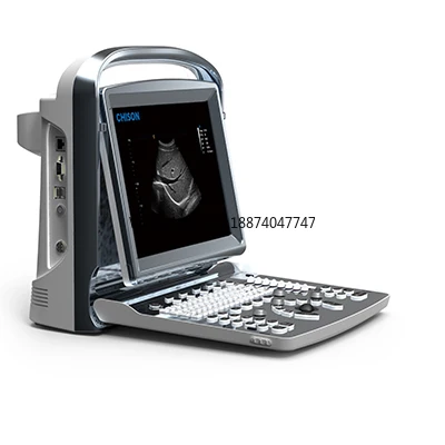 Medical Ultrasound Instruments portable doppler ultrasound Machine ECO1 Chison ultrasound Scanner price for human use