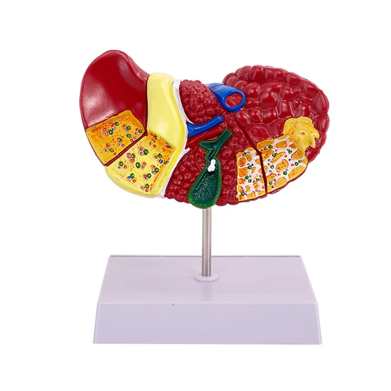 Liver Model Pathological Liver Model For Common Pathologies, Liver Model Human Anatomy  Office Anatomy Model