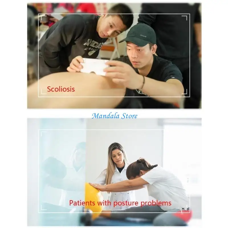 

U2JC Scoliosis Test Meter for Diagnosis of Back and Spine Scoliosis in Adults Children 0-30° Scoliosis Test Measuring Meter