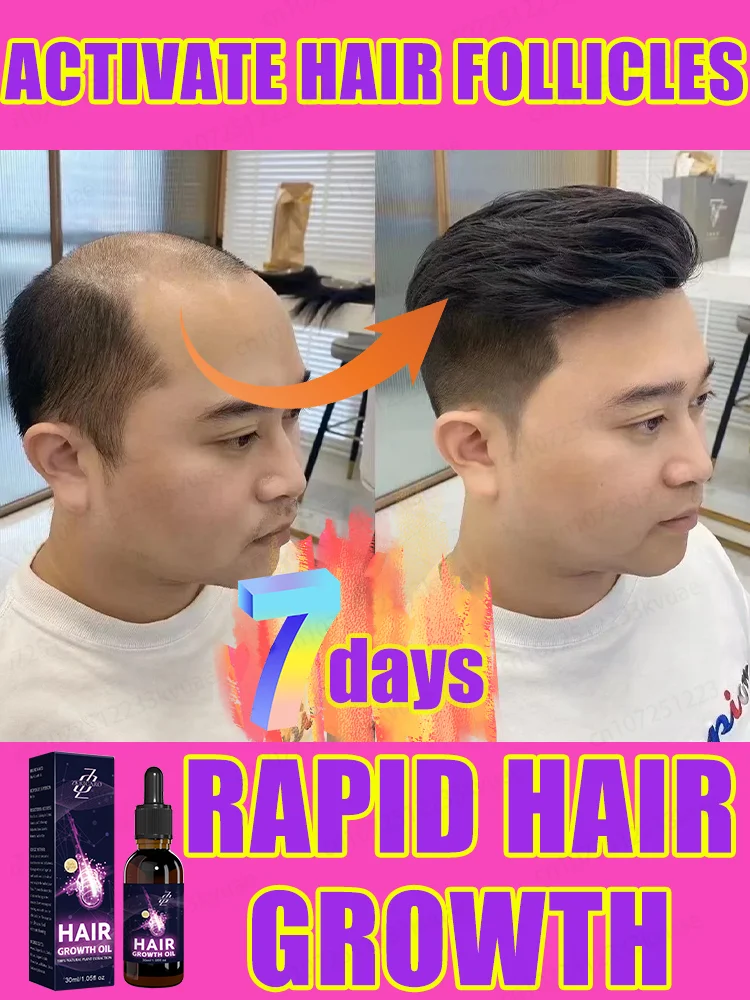 

ᔆᵗⁱᵐᵘˡᵃᵗᵉ ʰᵃⁱʳ ᶠᵒˡˡⁱᶜˡᵉˢ⸴nourish the scalp, and quickly regenerate hair in seven days