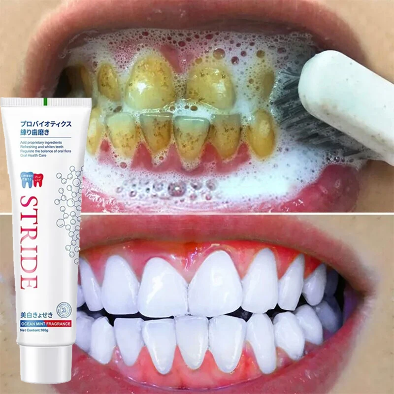 100g Dental Calculus Removal Toothpaste Teeth Whitening Remove Stains Bad Breath Preventing Periodontitis Dental Cleansing Care