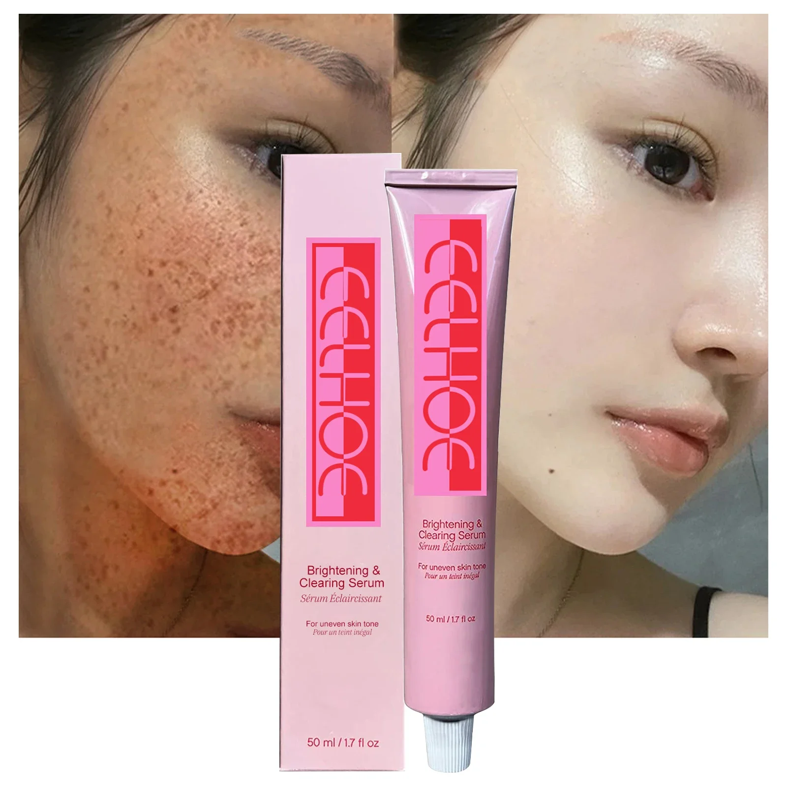 Effective Whitening Freckle Cream Fade Dark Spot whitening Essence Removal Melanin Melasma Lighten Brighten Smooth Skin Care