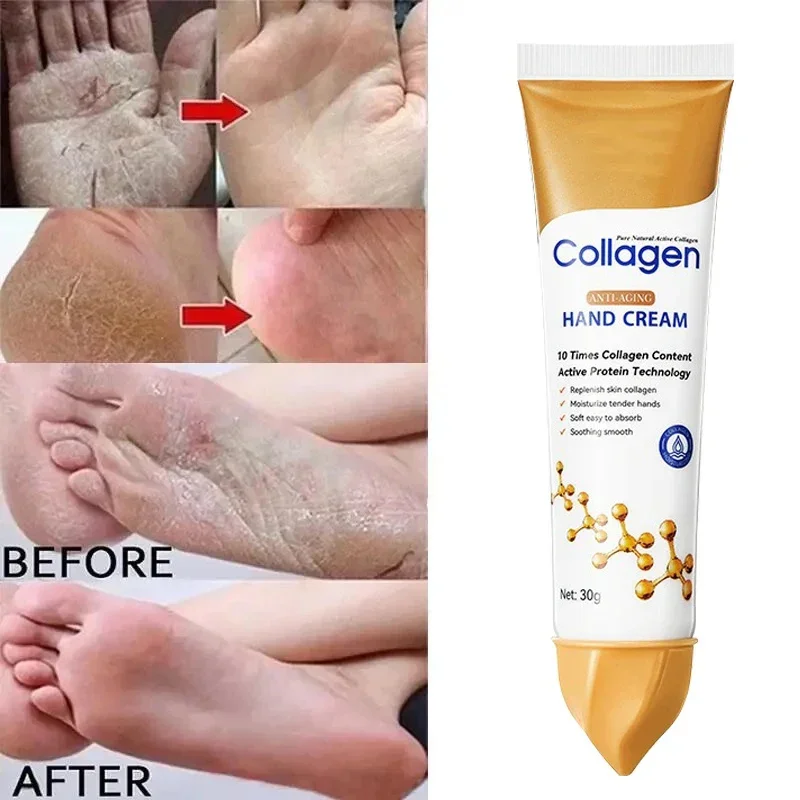 Dark Skin Elbows Pigmentation Hand s Skin Care Get Rid Of Dark Knuckles In 7 Days Serum Knuckle Dull Removal For Hand