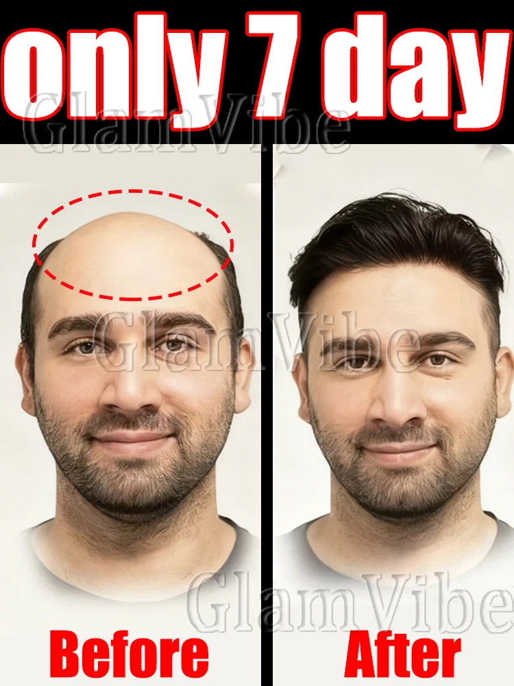 

повышение энергии, визуально подводное azi