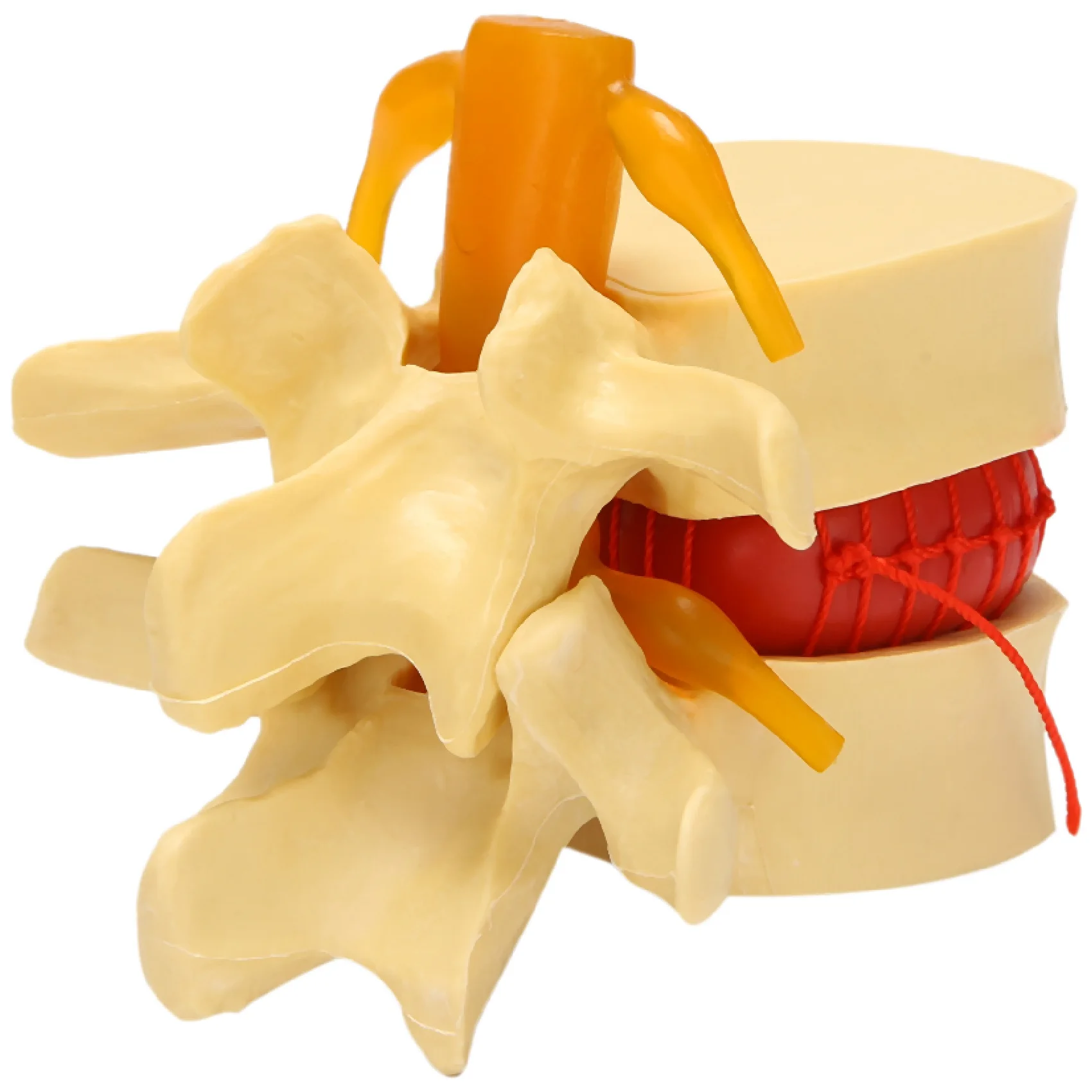 

Lumbar Vertebrae Model Anatomical Spine Lumbar Disc Herniation Anatomy Teaching Tool Lumbar Vertebrae Model