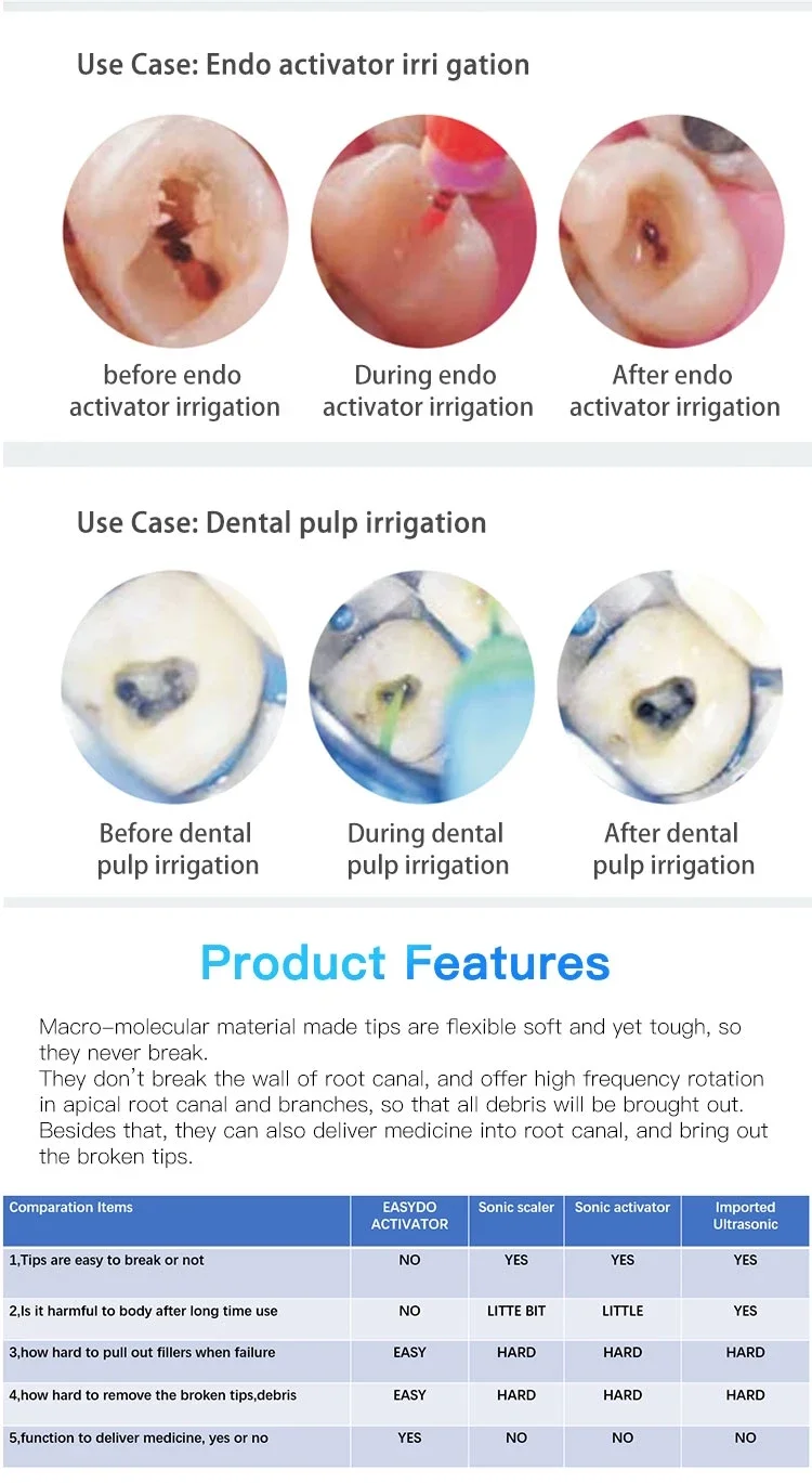 Easyinsmile -s Matrix Profecto Matrix band Matrice  -s Section Metal Matrix System 50 pcs per box curved band 4.5mm