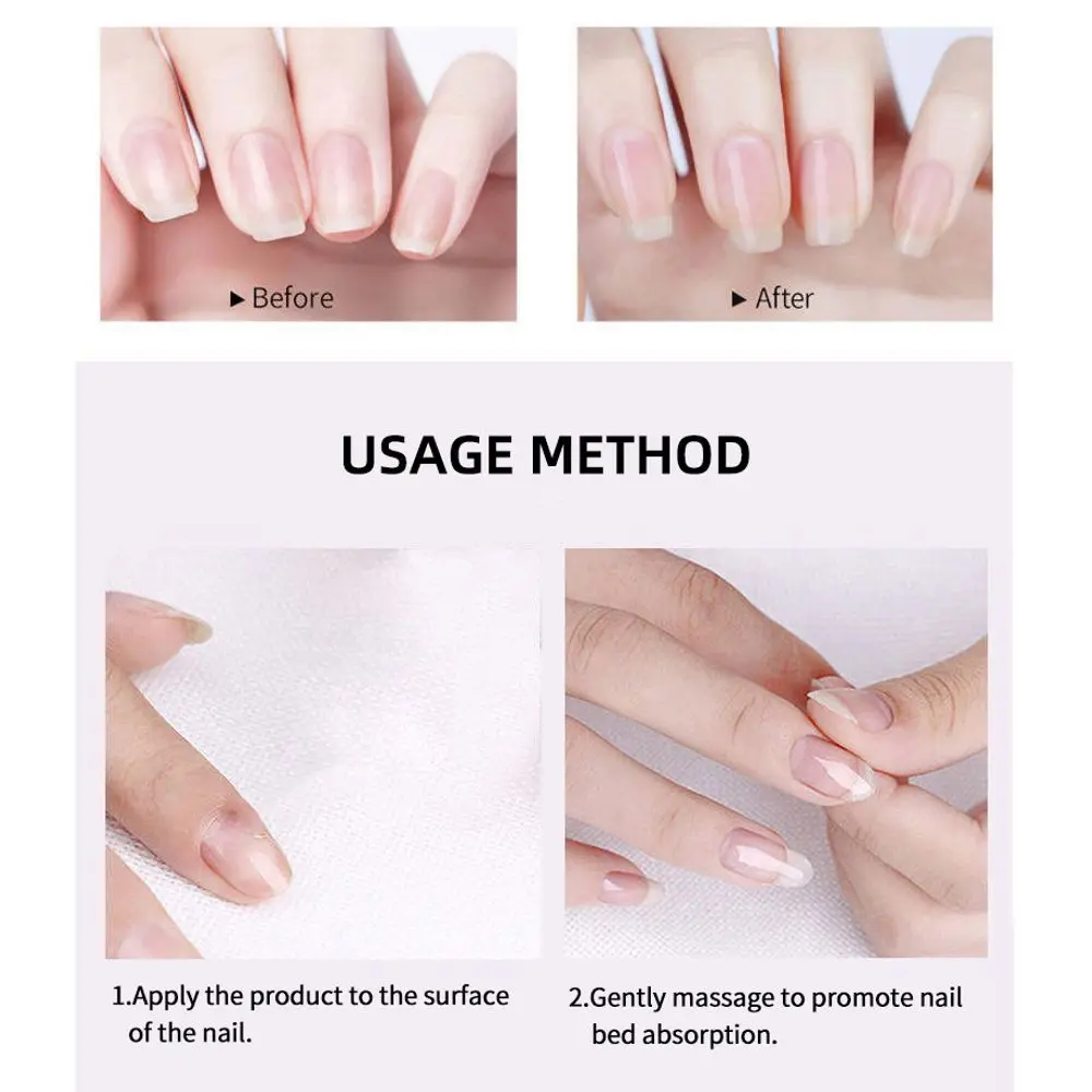 15ml Nail Nutrient Serum with Hyaluronic Acid, Keratin & Multi-Nutrients for Damaged Nail Repair & Nail Bed Care