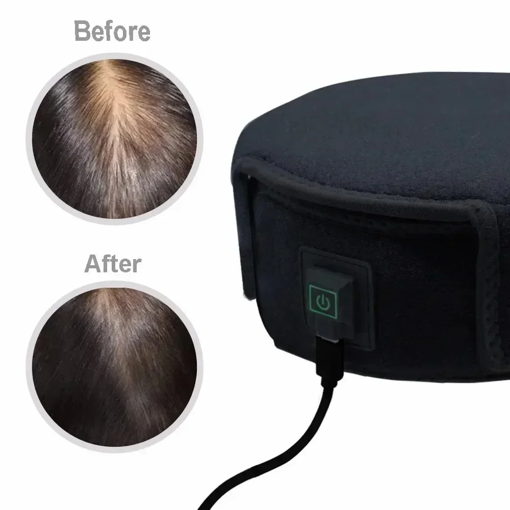 660 nm and 880 nm near infrared red light therapy devices to repair hair damage Promote hair regrowth Prevent hair loss hat