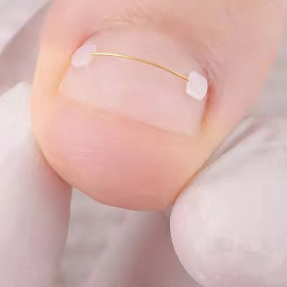 Correcteur d'ongles incarnés, lisseurs réutilisables, outils en alliage de titane, fil à ongles Compact, appareils professionnels pour un usage quotidien 6 pièces