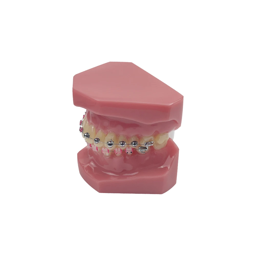 

Dental Teeth Model Orthodontic Model With Brackets 1/4 Spherical Self-Locking For Teaching Studying Dentist-Patient Education