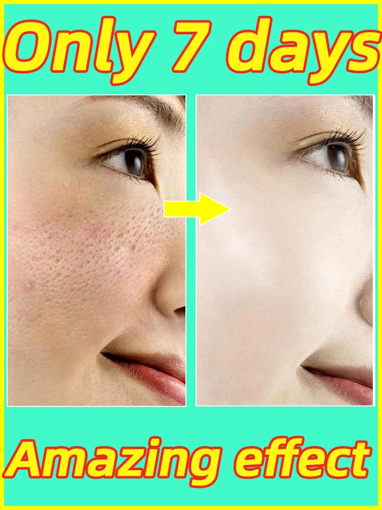 Pore Shrinking Serum Shrink Pores Cream Lactobionic Acid Shrink Pores Serum Face Firming Face Pore Repair Shrink Pores